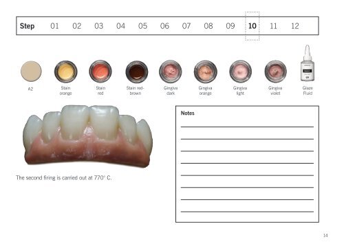 Soprano® Surface Gingiva. Step-by-step by Florian Steinheber.