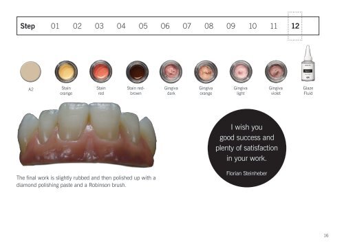 Soprano® Surface Gingiva. Step-by-step by Florian Steinheber.