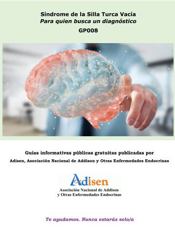 GP008 Síndrome de la Silla Turca Vacía, para quien busca un diagnóstico
