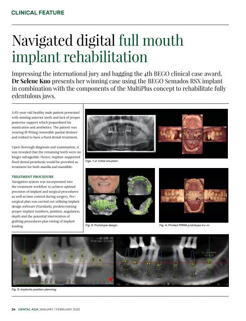 Dental Asia January/February 2023