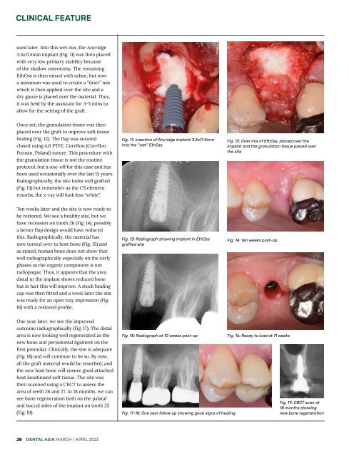 Dental Asia March/April 2023