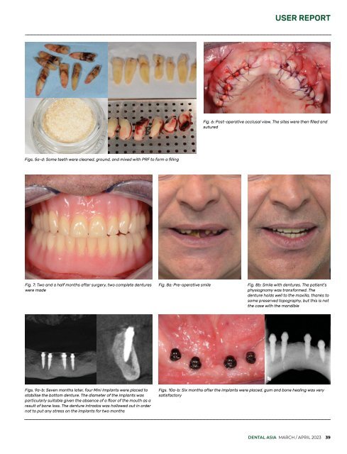 Dental Asia March/April 2023