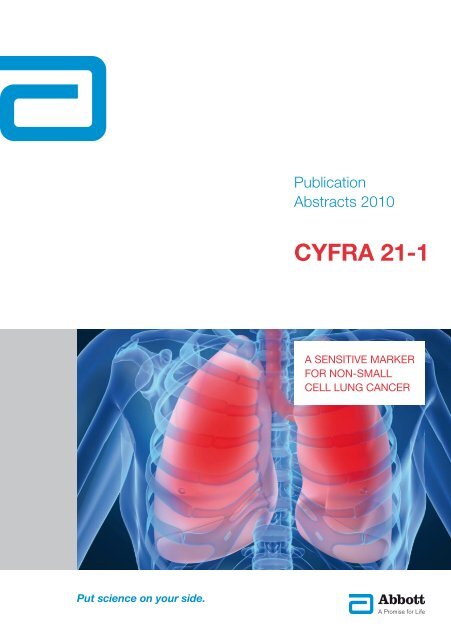 CYFRA 21-1 - ABBOTT Diagnostics