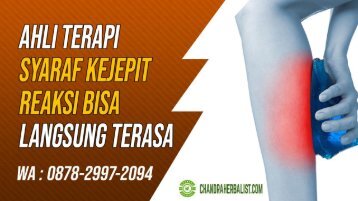 Langsung Terasa! 0878-2997-2094 Ahli Terapi Pengobatan Syaraf Kejepit Di Jeruklegi Kesugihan Terapi Saraf Kejepit Cilacap