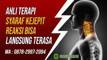 0878-2997-2094 Pengobatan Terapi Saraf Kejepit Di Sidareja Cimanggu, Alamat Tempat Ahli Terapi Syaraf Kejepit Cilacap