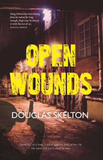 Open Wounds by Douglas Skelton sampler