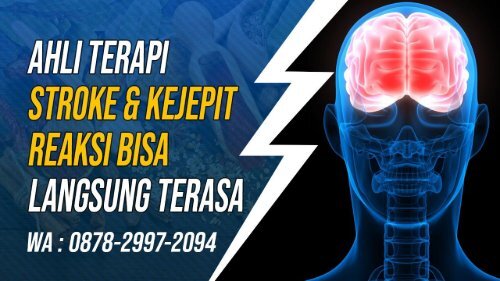 0878-2997-2094 Ahli Terapi Pengobatan Stroke Di Kroya, Tempat, Alamat, Jasa,