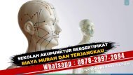 Sekolah Akupunktur!!! (Wa:0878-2997-2094) Info Kuliah Kursus Pelatihan Akupuntur Bersertifikat Biaya Murah