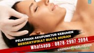 Wa : 0878-2997-2094 Kursus Pelatihan Akupunktur Di Kebumen Bersertifikat Biaya Murah