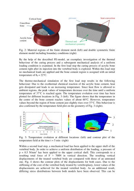 ARUP; ISBN: 978-0-9562121-5-3 - CMBBE 2012 - Cardiff University