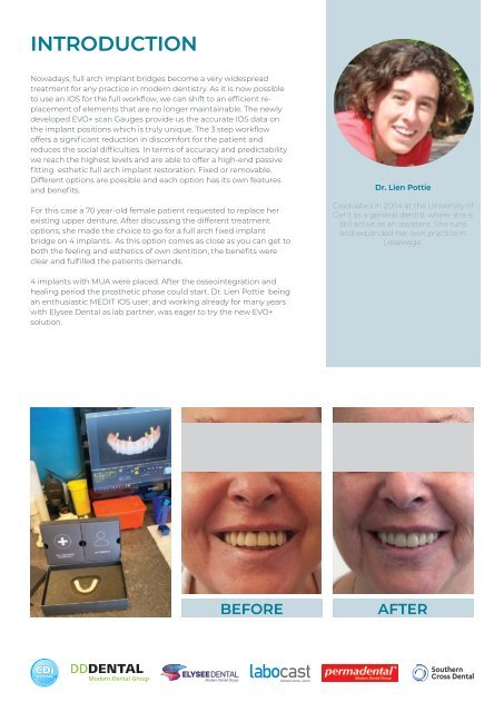 NL21_Casereport_Evo plus_Case 2