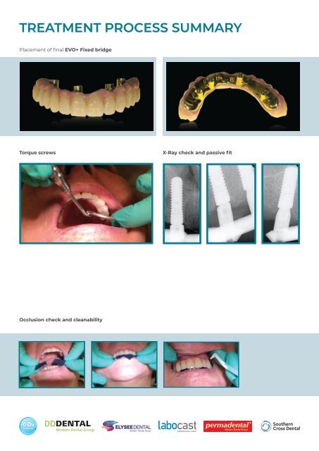 NL21_Casereport_Evo plus_Case 2