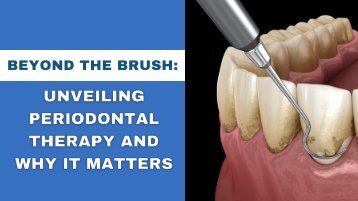 Beyond the Brush: Unveiling Periodontal Therapy and Why It Matters