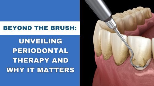 Beyond the Brush: Unveiling Periodontal Therapy and Why It Matters