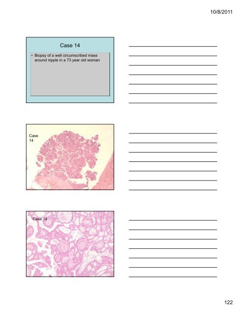 33 Special Types of Invasive Breast Carcinoma: Diagnostic Criteria ...