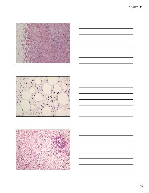 33 Special Types of Invasive Breast Carcinoma: Diagnostic Criteria ...