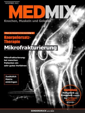 MEDMIX-Innovative Knorpelersatztherapie bei Arthrose