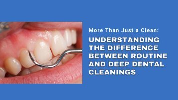 More Than Just a Clean: Understanding the Difference Between Routine and Deep Dental Cleanings