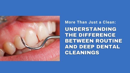 More Than Just a Clean: Understanding the Difference Between Routine and Deep Dental Cleanings