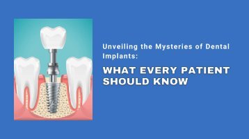 Unveiling the Mysteries of Dental Implants: What Every Patient Should Know