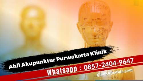 O857-24O4-9647 Ahli Akupunktur Purwakarta Klinik Alhafidz Pengobatan Akupunktur Untuk Stroke