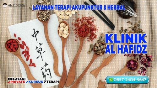 0857-2404-9647 Klinik Akupunktur Di Karawang Tempat Ahli Terapi Pengobatan Akupuntur Terdekat