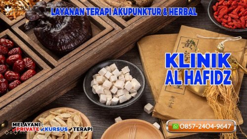 0857-2404-9647 Pengobatan Akupunktur Di Karawang Klinik Al Hafidz Tempat Terapi Akupuntur Terpercaya