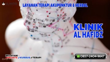 O857-24O4-9647 Akupunktur Bandung Barat Terapi Pengobatan Akupunktur Terpercaya