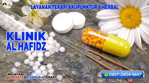 O857-24O4-9647 Terapi Akupunktur Di Bandung Barat Klinik Al Hafidz Tempat Pengobatan Stroke