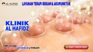 0857-2404-9647 Jasa Terapi Pengobatan Bekam Di Purwakarta