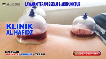 0857-2404-9647 Klinik Pengobatan Terapi Bekam Di Purwakarta