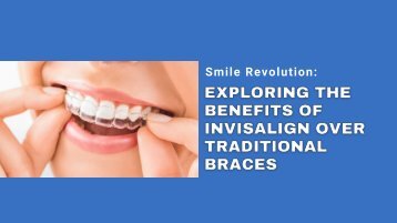 Smile Revolution: Exploring the Benefits of Invisalign over Traditional Braces