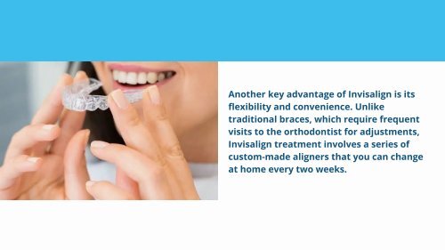 Smile Revolution: Exploring the Benefits of Invisalign over Traditional Braces