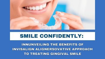 Smile Confidently: Unveiling the Benefits of Invisalign Aligners