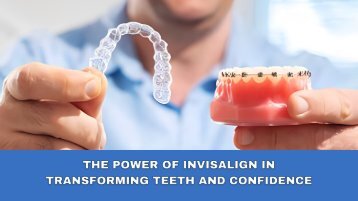 The Power of Invisalign in Transforming Teeth and Confidence