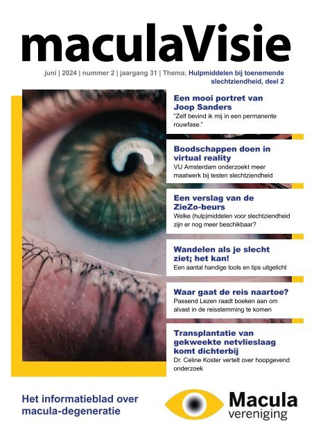MaculaVisie 2 - 2024