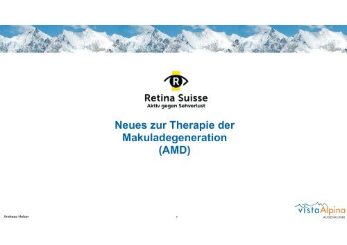 Neues zur Therapie der Makuladegeneration (AMD)