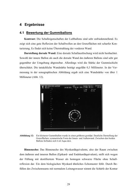 Entwicklung und Konstruktion eines pulsatilen Herzmodells zur ...