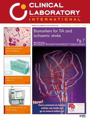 Biomarkers for TIA and ischaemic stroke Pg.7 - CLI Online