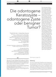Die odontogene Keratozyste - Professor Dr. Andreas Filippi ...