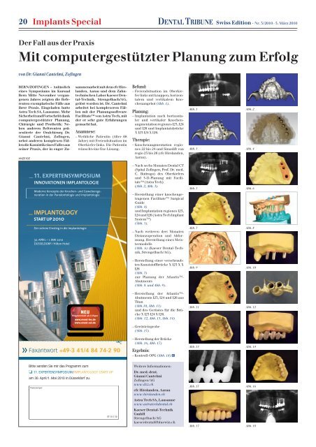 Implants Special DENTALTRIBUNE Swiss Edition - Oemus Media AG