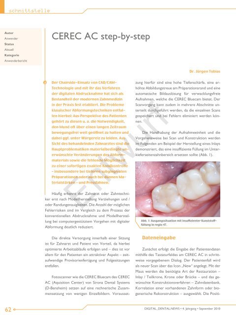 CEREC AC step-by-step - Dr. Jürgen Tobias