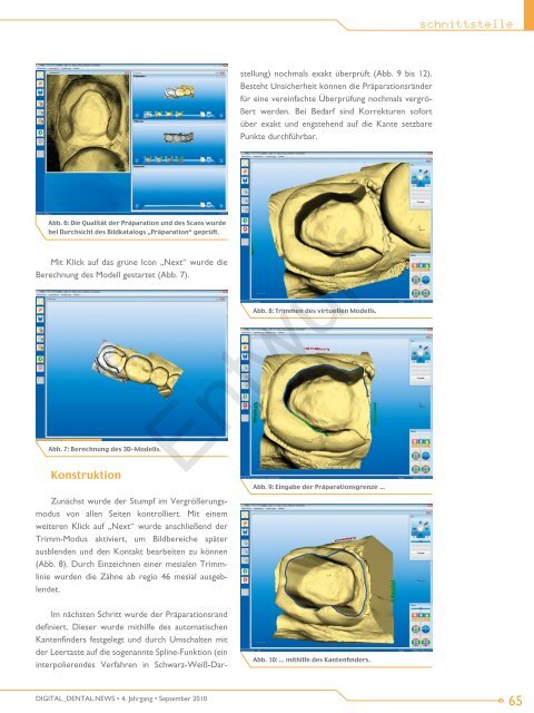 CEREC AC step-by-step - Dr. Jürgen Tobias