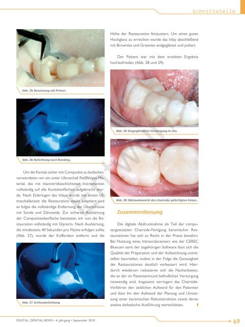 CEREC AC step-by-step - Dr. Jürgen Tobias