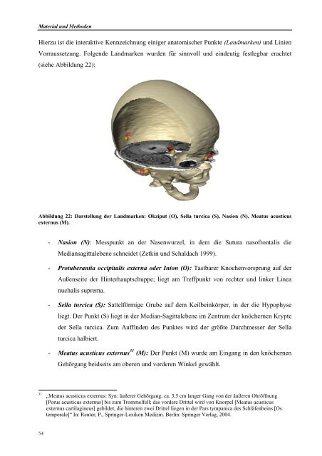 DISSERTATION Modellgebundene Cranioplastie ... - ZIB