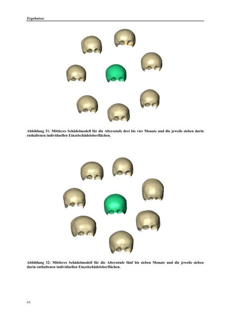 DISSERTATION Modellgebundene Cranioplastie ... - ZIB