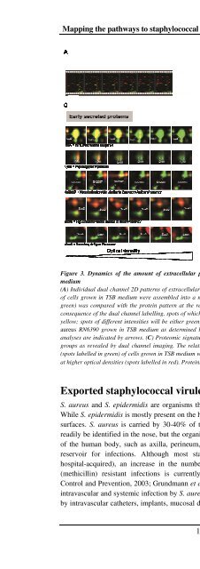 The Staphylococcus aureus secretome - TI Pharma