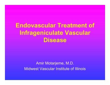 Endovascular Treatment of Infrageniculate Vascular Disease