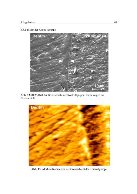 Dentin Komposit - OPUS - Universität Würzburg