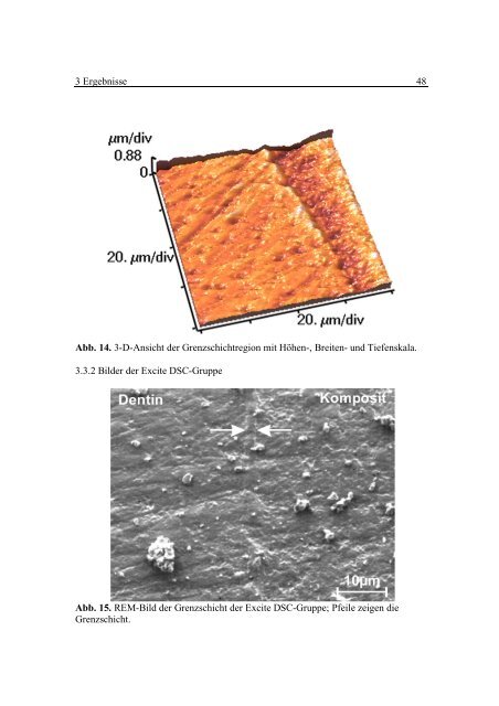 Dentin Komposit - OPUS - Universität Würzburg